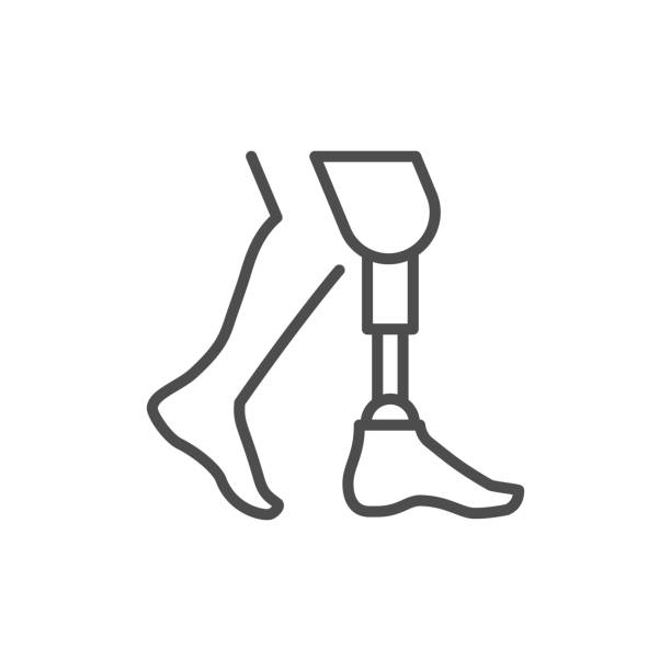 Custom Prosthesis