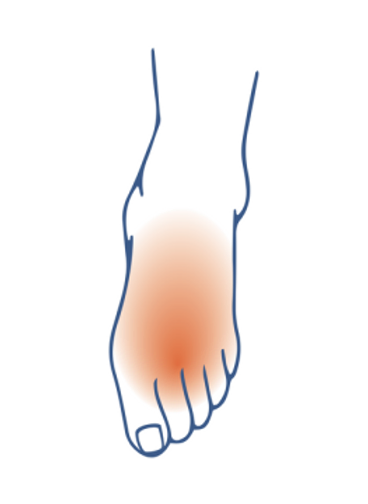 Diabetic Foot Care